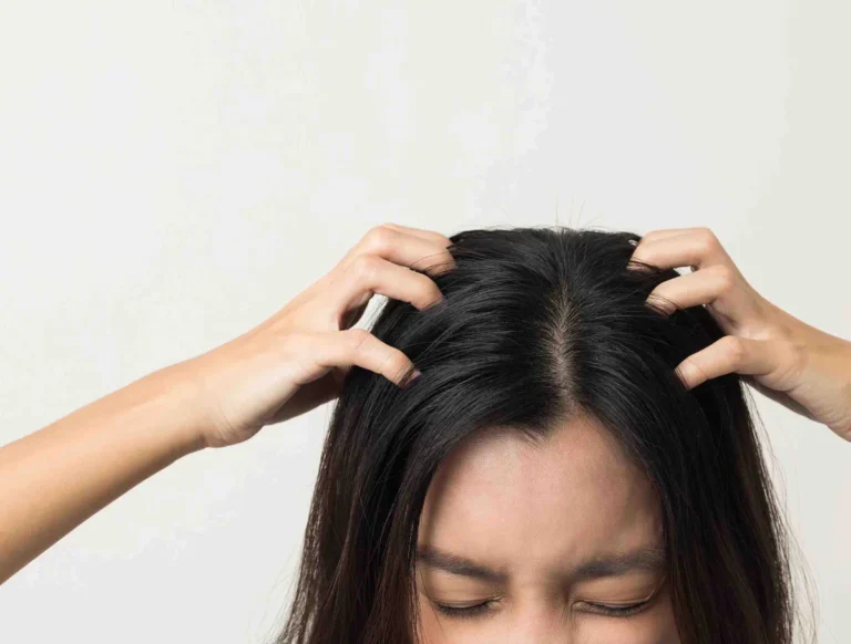 Sensitive scalp care — SIMONE TRICHOLOGY