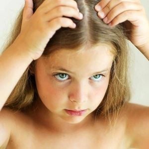 Hair Loss in Children - Caída de cabello en niños