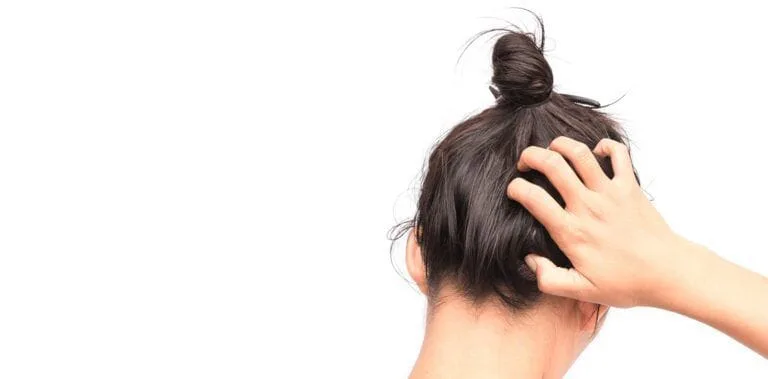 Fedtet-hår-Cabello-Graso-SIMONE-TRICHOLOGY