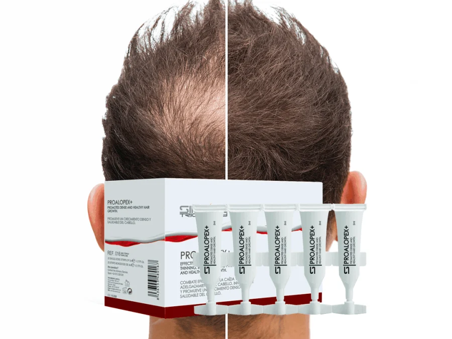Embalagem e frascos monodose PROALOPEX+ para a queda de cabelo androgenética — SIMONE TRICHOLOGY