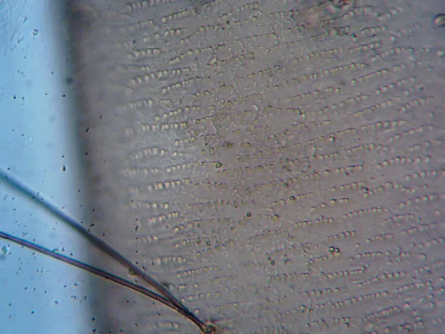 Magnified view of a hair strand and its follicle under a microscope, illustrating hair structure