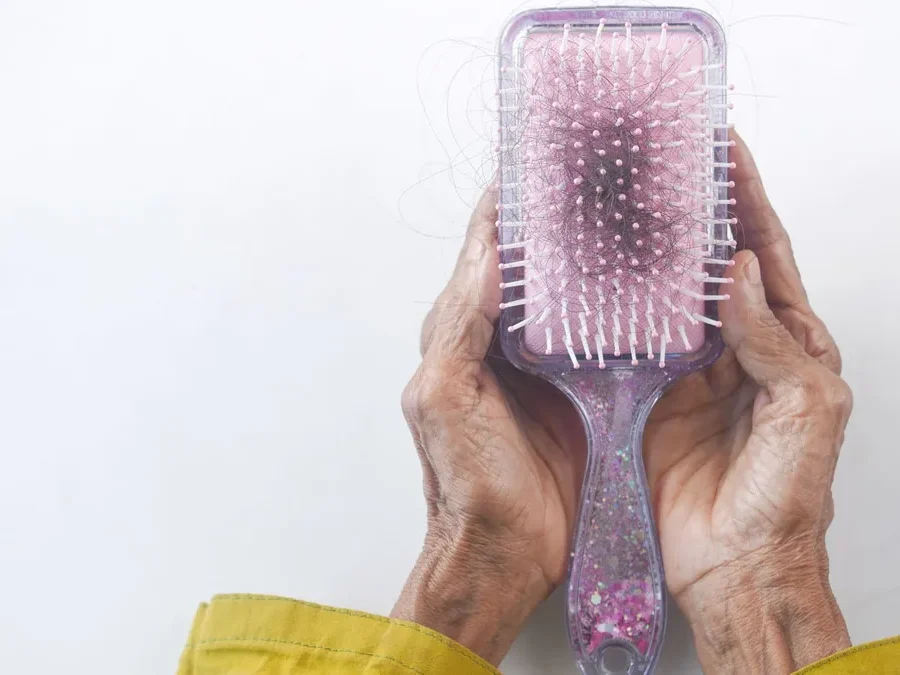 Wrinkled hands holding a hairbrush with shed hairs caught in it, a common sign of telogen effluvium