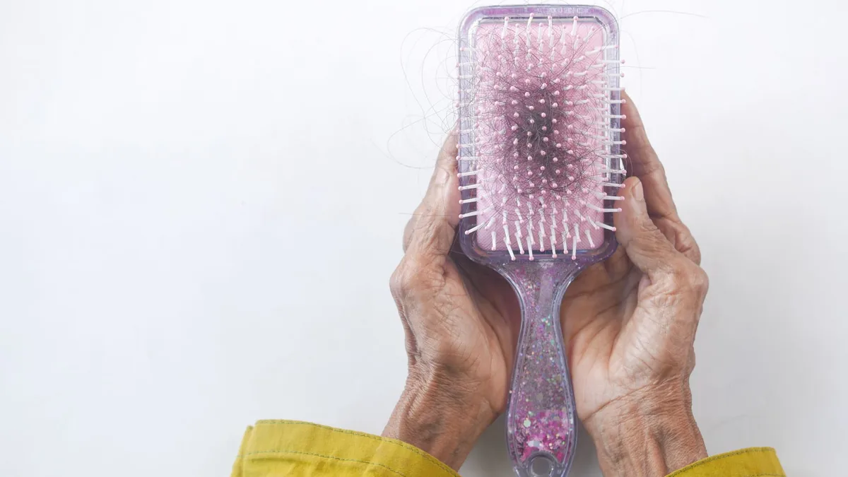 Wrinkled hands holding a hairbrush with shed hairs caught in it, a common sign of telogen effluvium
