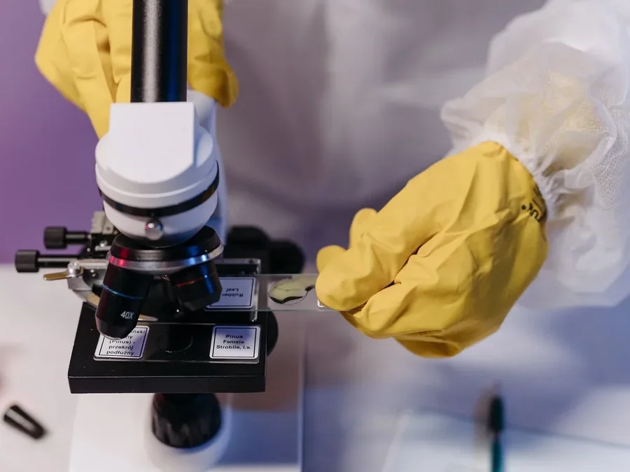 Close-up of a microscope with a glass slide, as used to examine a scalp biopsy sample for hair loss diagnosis